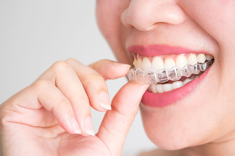 Orthodontics in Ridgefield